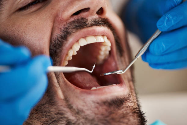 Best Emergency Dentist for Knocked-Out Tooth in Newton, IA