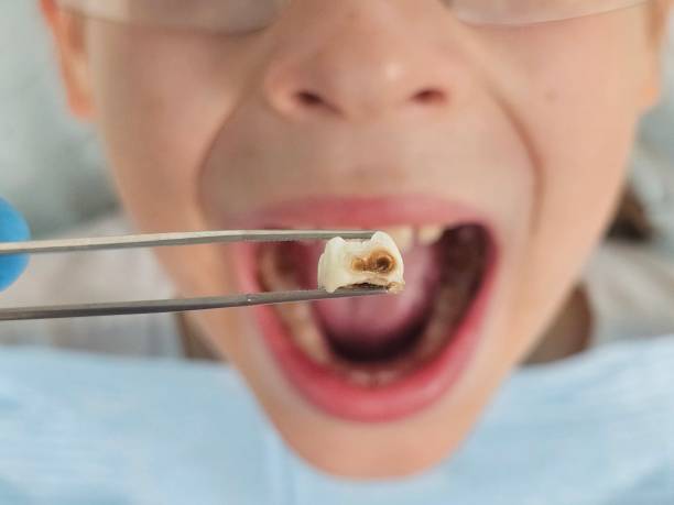 Best Emergency Dentist for Special Needs Patients in Newton, IA